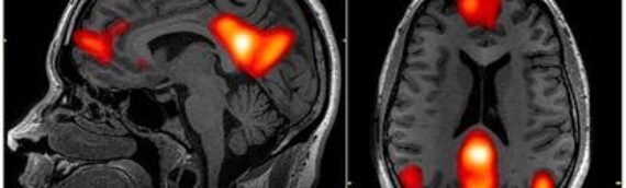 The Science of Rewiring the Mind: Hypnotherapy vs. Psychedelic-Assisted Therapy